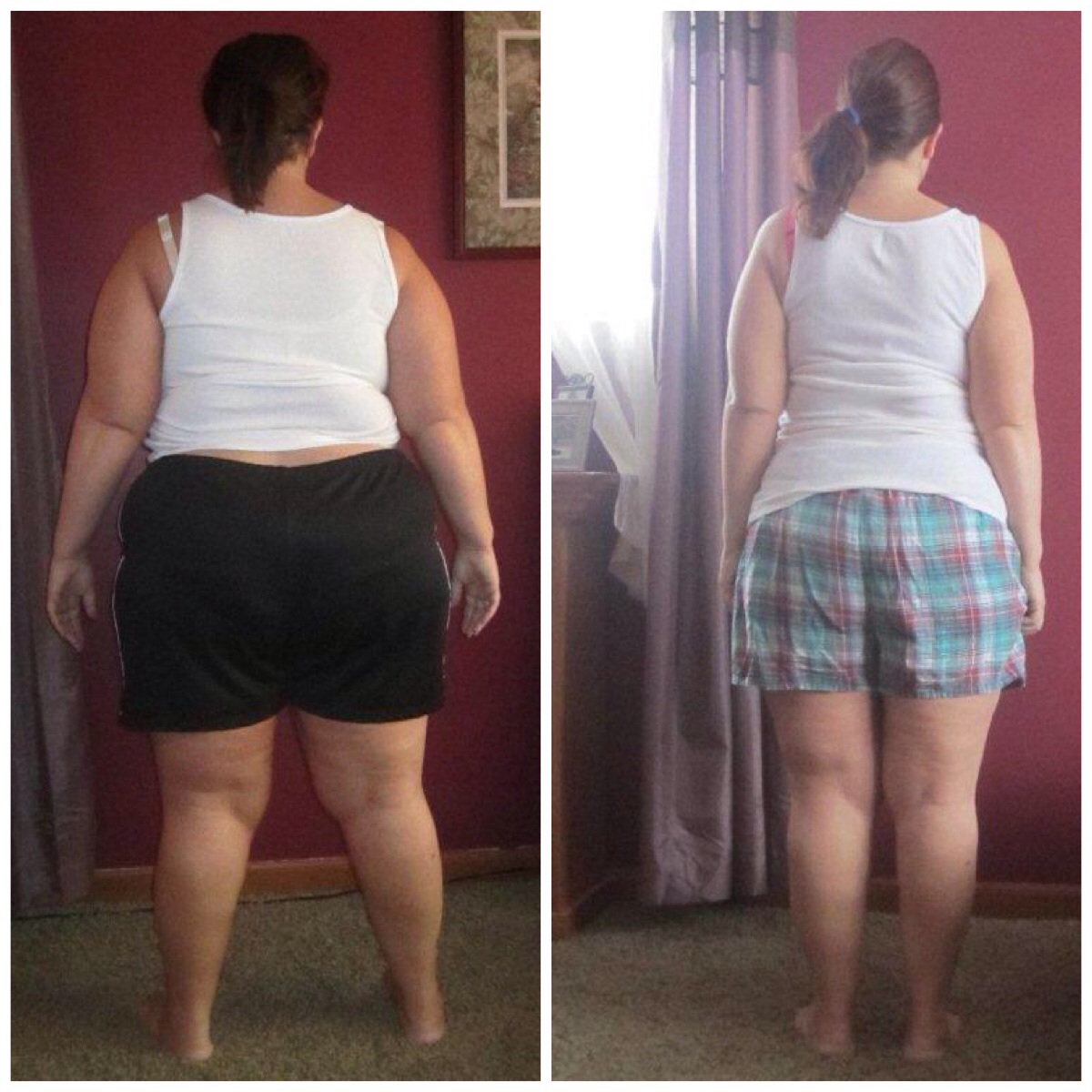 6 Months Pics Tell Your Gastric Sleeve Surgery Story Bariatricpal 6606